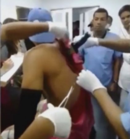 В Колумбии мужчина сам добрался до больницы с мачете в спине